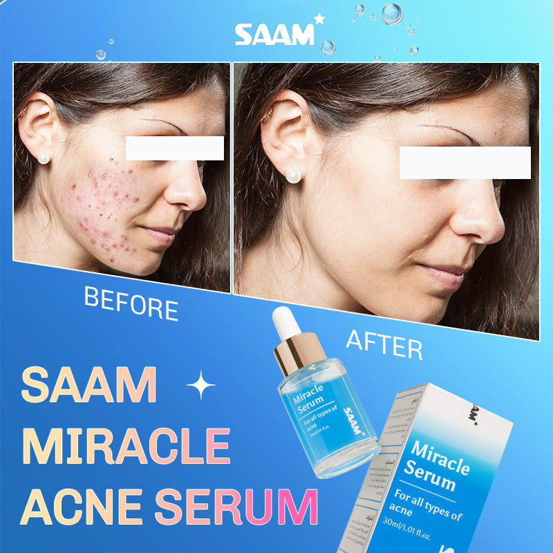 Saam miracle acne serum clear stubborn all acne