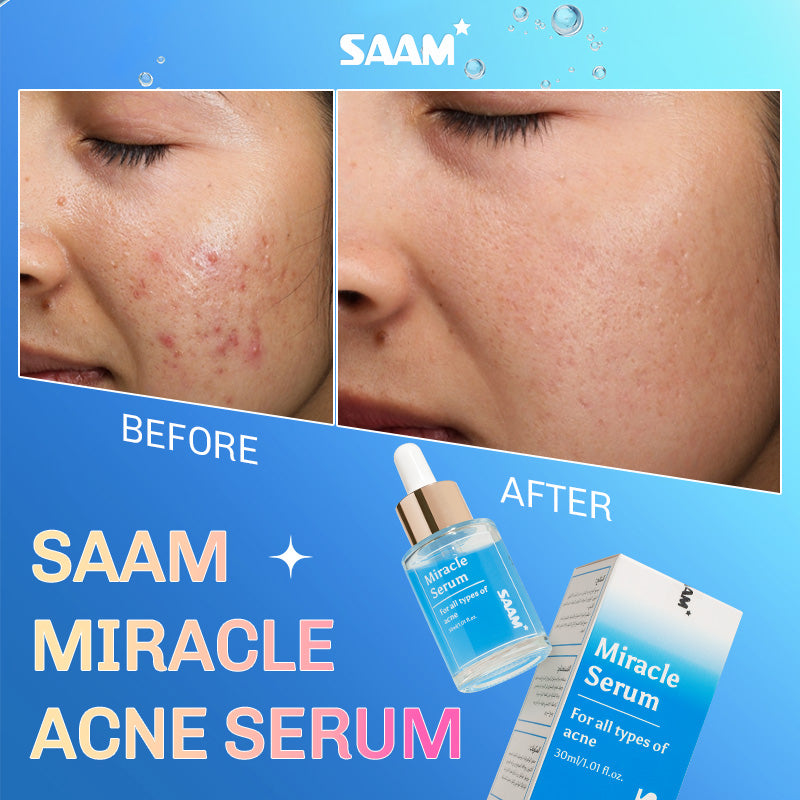 Saam miracle acne serum clear stubborn all acne