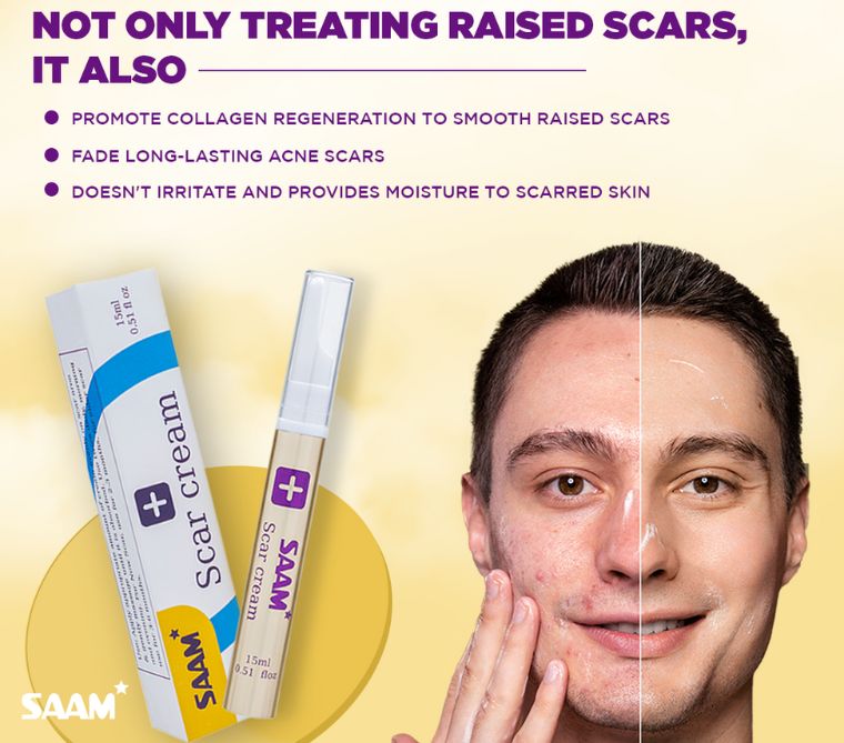 Saa Scar Cream Fade Minor Scars & Achieve Even Skin Tone